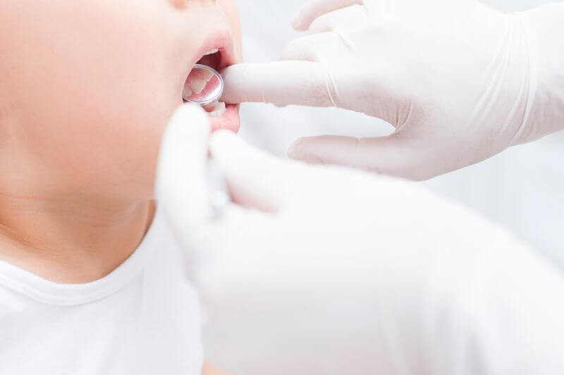 口腔内を観察する歯科医師